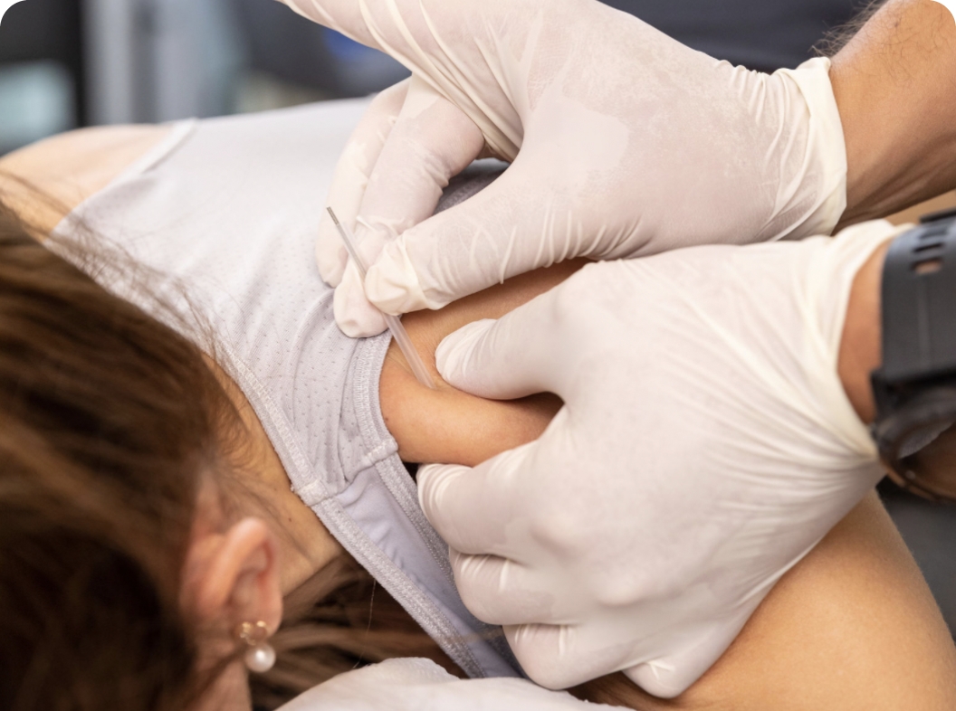 The Science Behind Acupuncture Treatment